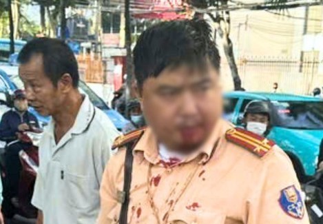 Khởi tố bị can Khafizov Artur (quốc tịch Nga) vì hành vi tấn công CSGT