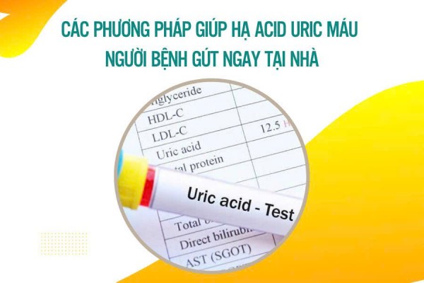 Các phương pháp giúp hạ axit uric máu cho người bệnh gút ngay tại nhà